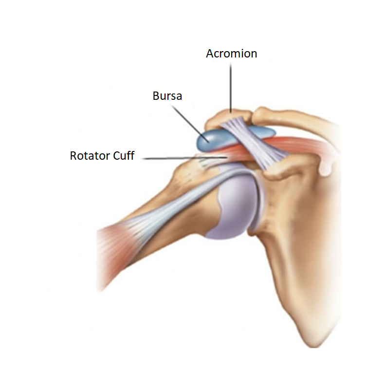 Impingement Syndrome Image